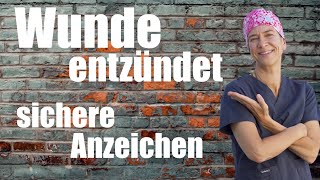 WUNDE entzündet WORAN merke ich das WEISHEITSZAHNOP [upl. by Janet]