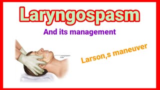 Laryngospasm and its management  Larson maneuver anaesthesiawithbabar2576 [upl. by Ihcekn616]