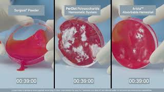 PERCLOT Polysaccharide Hemostatic System Comparison [upl. by Ybbil235]