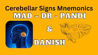 Cerebellar Signs Mnemonics  MAD DR PANDI amp DANISH [upl. by Cos]