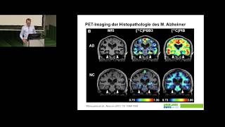 Neurobiologische Grundlagen psychischer Störungen [upl. by Jadda]