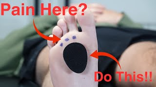 Metatarsal Pad Correct Placement [upl. by Ripleigh]