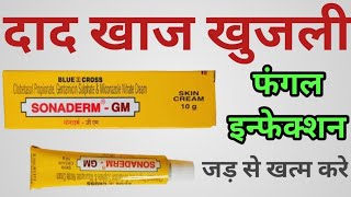 Sonaderm GM Skin Cream Uses  फंगल इनफेक्शन दाद खाज खुजली जड़ से खत्म करे [upl. by Mou632]