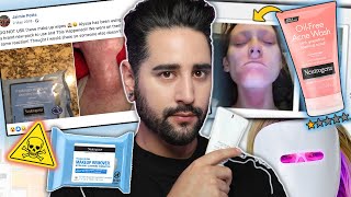 The Makeup Wipes That Caused Chemical Burns  The Neutrogena Lawsuit  When Beauty Turns Ugly [upl. by Annawaj]