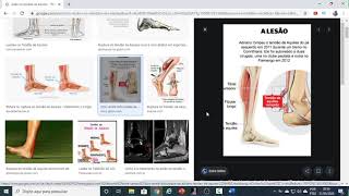 Anatomia Humana  QUESTÕES Sistema Articular [upl. by Aicissej577]