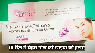 Elosone ht skin cream elosone ht cream elosone ht cream kaise uses kare elosone ht cream benefits [upl. by Sira]