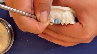 Encerado de un primer molar superior FACIL Paso a paso  upper first molar wax up [upl. by Nylzaj583]