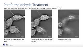 A study on effects of fixation with Formaldehyde and Paraformaldehyde [upl. by Komsa]