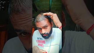 Day 21 My oil testing for hair regrowth hairfall hairlosstreatment hairgrowth homeremedies [upl. by Gare]