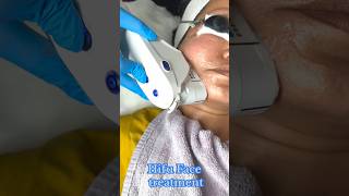 Hifu treatment Skin tightening treatment ✅Skin smile clinic Bhopal hifu skintightening Bhopal [upl. by Odlawso]