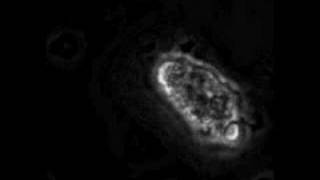 A macrophage sends out pseudopodia to engulf a fungal spore [upl. by Ebanreb]