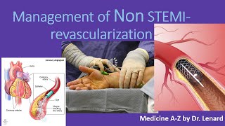 Management of Non STEMI Timing for PCI Anticoagulation antiplatelet UN VS NSTEMI [upl. by Danny295]