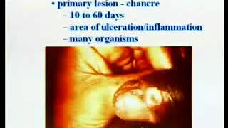 222 Neisseria and Spirochetes  Medical Microbiology [upl. by Edlihtam]