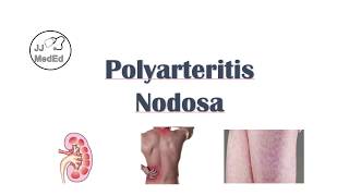 Polyarteritis Nodosa PAN  Signs amp Symptoms Diagnosis Treatment [upl. by Onairda]