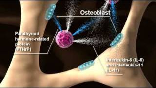 IMER 3D Mechanism of Action Video The Bone Microenvironment [upl. by Arie]