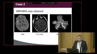 Neurologic Complications of Obstetrical Anesthesia [upl. by Muller]