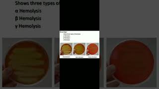 Haemolysis on streptococci and its types microbiology biology subscribe 👍😍🧫🔬 [upl. by Ravo]