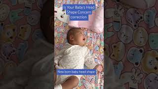 Is Your Babys Head Shape a Concern 2024  Try our Head Shape Correction Pillow Baby shortsbaby [upl. by Airogerg778]