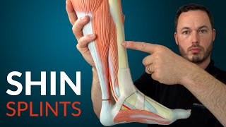 Understanding SHIN SPLINTS and how to fix it [upl. by Leibman]