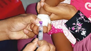 Meropenem injection Cannula  Child  তে Push 24 Ep 39 By Injection Tv [upl. by Zabrina]