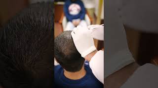 Wondering how to begin your hair restoration treatment  Hair Transplant Clinic [upl. by Mccarty608]