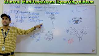 Clinical Manifestations of Hyperthyroidism part i [upl. by Adnahc892]