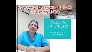 Como saber si una HERIDA esta SANANDO [upl. by Algie]