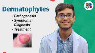 Dermatophytosis  Cutaneous mycosis  Dermatophytes  Microbiology bangla lecture [upl. by Rossy598]