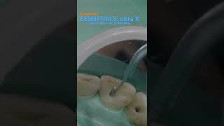 Essentials in endodontics ULTRA X eighteeth [upl. by Atsiuqal917]