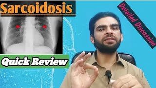 sarcoidosis in urdu hindi  signs amp symptoms investigations treatment [upl. by Anaeerb385]