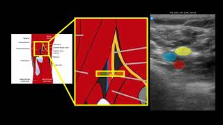 Anatomy for US guided Tibial nerve block in popliteal fossa [upl. by Chi]