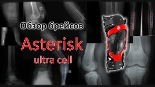 Обзор Asterisk ultra cell Разговор о наколенниках [upl. by Miner]