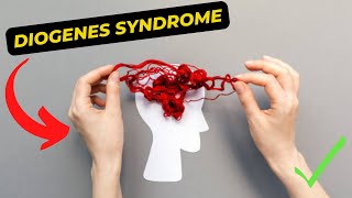 How To Help A Person With Diogenes Syndrome [upl. by Goren]