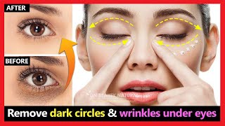 Brighter eyes quickly Remove dark circles under eyes amp wrinkles under eyes naturally  Eyes massage [upl. by Yraeht]