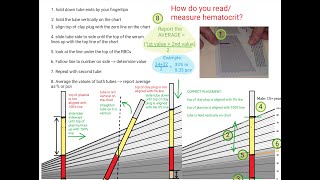 Hematocrit Review [upl. by Poole218]