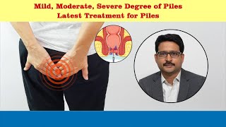 Treatment options for piles  Dr Sujay B R  Nano hospitals bengaluru [upl. by Newell]