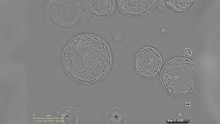 Growth of Liver Organoids in HepatiCult™ Culture Medium Under a Microscope [upl. by Tnecniv]