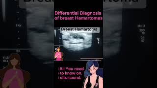 Benign Breast Tumors differential diagnosis of Hamartomas health healthytips DrSaimakhan [upl. by Anemolif]