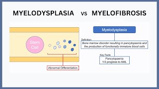 Myelodysplasia vs Myelofibrosis Explained [upl. by Wilone]