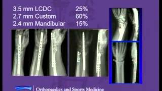 Orthopaedic Grand Rounds Contemporary Perspectives in Distal Radius Fracture Fixation [upl. by Lela212]