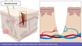 Skin Wound Healing Process [upl. by Issor]