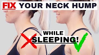 BEST sleeping position to FIX Neck Hump Hunchback or Forward Head Posture  Dr Jon Saunders [upl. by Lura]