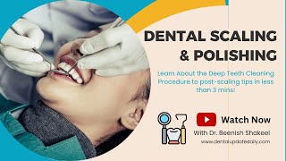 What is Dental Scaling and Polishing  Deep Teeth Cleaning Procedure [upl. by Inez230]