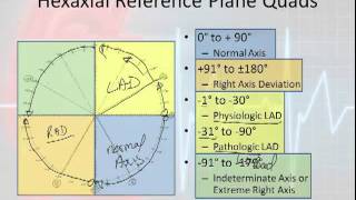 12 Lead Interpretation Part 3 Rwave Progression Electrical Vectors amp Axis Deviations [upl. by Primavera]