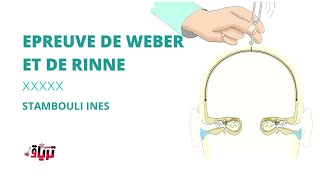 Sémiologie  EPREUVE DE WEBER ET DE RINNE par STAMBOULI INES [upl. by Aerdnak]