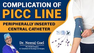 Understanding Complications and Management of Peripherally Inserted Central Catheters PICC line [upl. by Bury716]