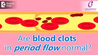 Why does menstrual bleeding have blood clots Is it normalDrShalini Varma of Cloudnine Hospitals [upl. by Dieball]