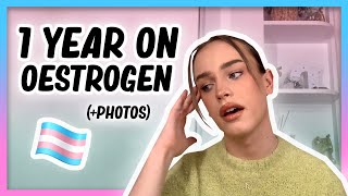 1 YEAR ON OESTROGEN Transition update with photos  Hormone Diaries [upl. by Freemon13]