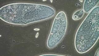 Paramecia Contractile Vacuoles by Edwin Lee [upl. by Inek]