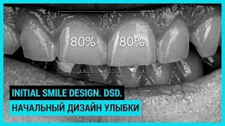 Initial smile design DSD Начальный дизайн улыбки [upl. by Camile]